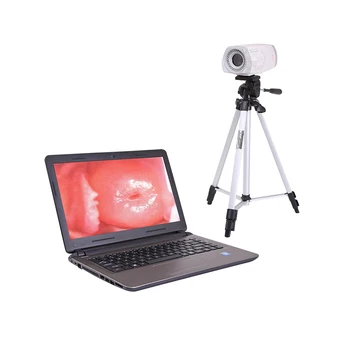 SUNNYMED SY-F003 оснащен портативным цифровым кольпо с цветной ПЗС-матрицей, позволяющим снимать видео для гинекологии